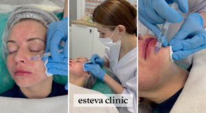 Биоревитализация в Esteva Clinic