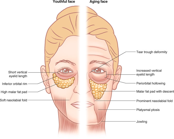 How to quickly lift your face without surgery - Esteva Clinic