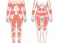 Как убрать жир с коленей косметологически - Esteva Clinic