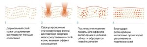 smas как работает