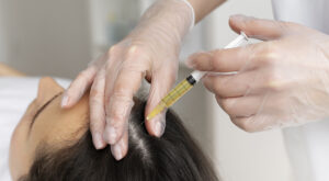 Hair mesotherapy