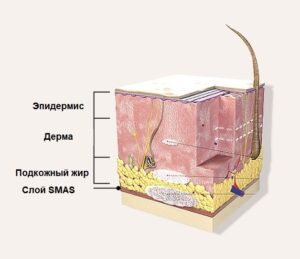 СМАС лифтинг кожа