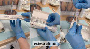 Biorevitalization in Esteva Clinic