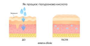 How Biorevitalization Could Change Your Skin