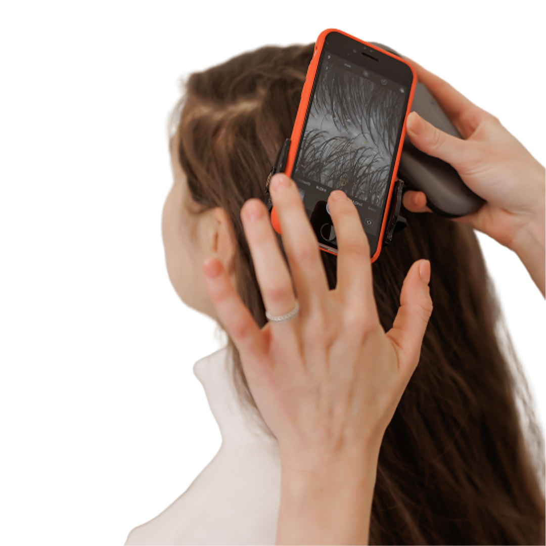 Огляд шкіри голови трихологом