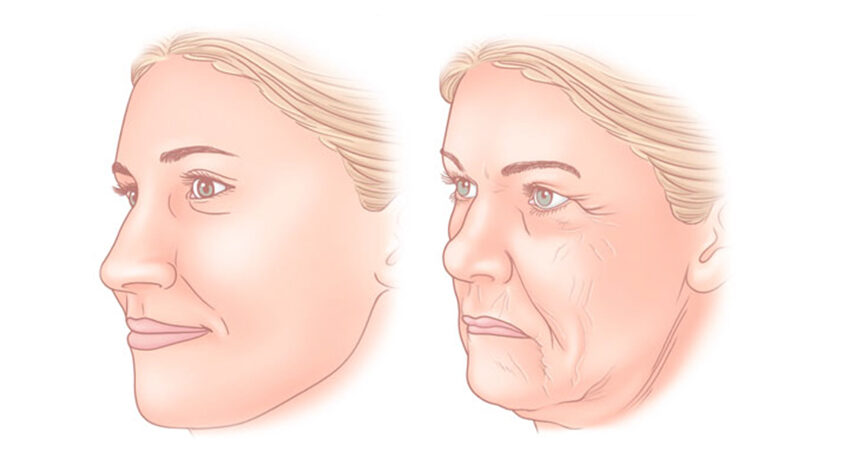 Face lifting in Esteva Clinic