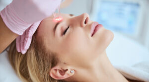 Laser skin resurfacing