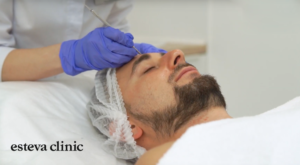 Чистка обличчя для чоловіків в Esteva Clinic