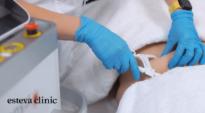 Cryolipolysis in Esteva Clinic