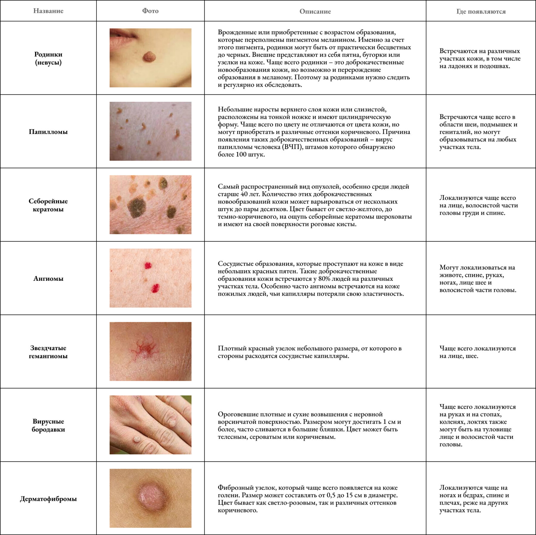 наросты на коже человека название и описание
