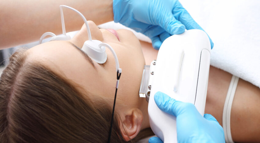 IPL (removal of blood vessels and pigmentation)