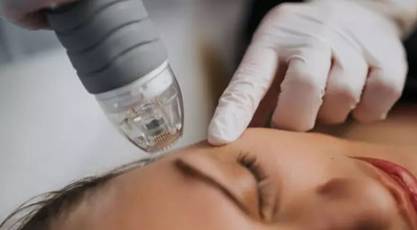 Eyelid rejuvenation without surgery