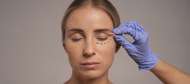 Eyelid rejuvenation without surgery