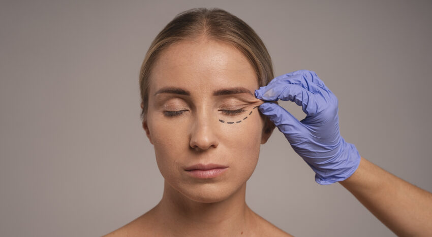 Eyelid rejuvenation without surgery